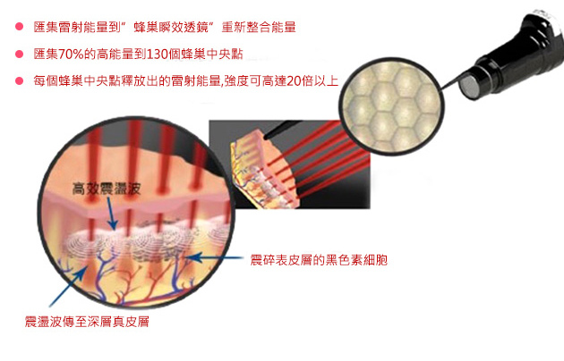 PicoSure蜂巢皮秒機械光雷射除皺雷射皮秒雷射除皺細紋凹疤雀斑曬斑斑點肝斑淨膚雷射飛梭雷射上立皮膚科診所2.jpg