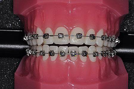 SAhCJJxWvRgYzbn1dlDKeQ