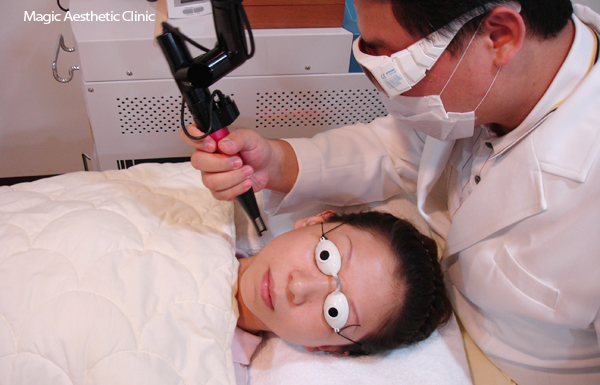 白瓷娃娃淨膚雷射