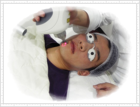 飛梭雷射+水涵氧