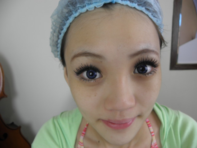 白瓷娃娃淨膚雷射