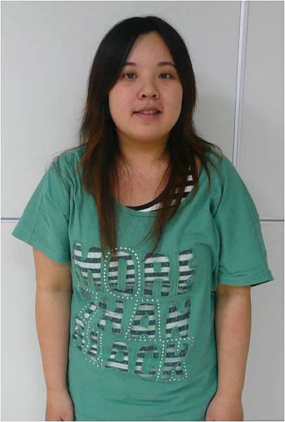 許雅婷埋線減重前.jpg 許雅婷埋線減重前.jpg
