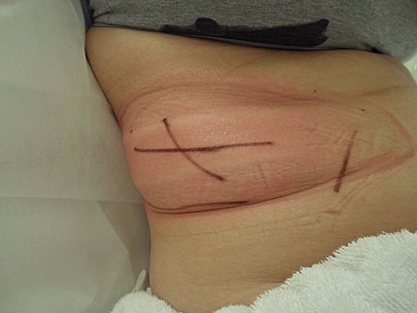 照片 11133 照片 11133