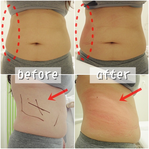 照片 11144 照片 11144