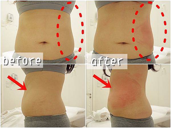 照片 11226 照片 11226