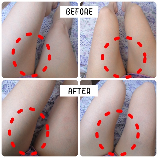 照片 11609 照片 11609