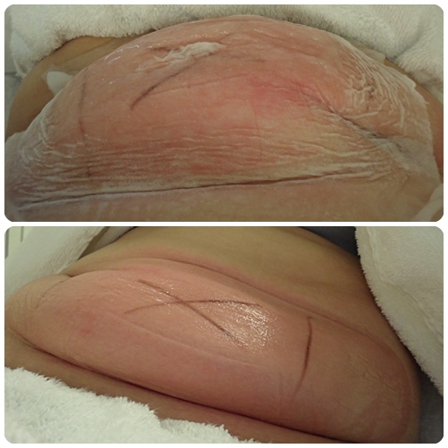 照片 11607 照片 11607