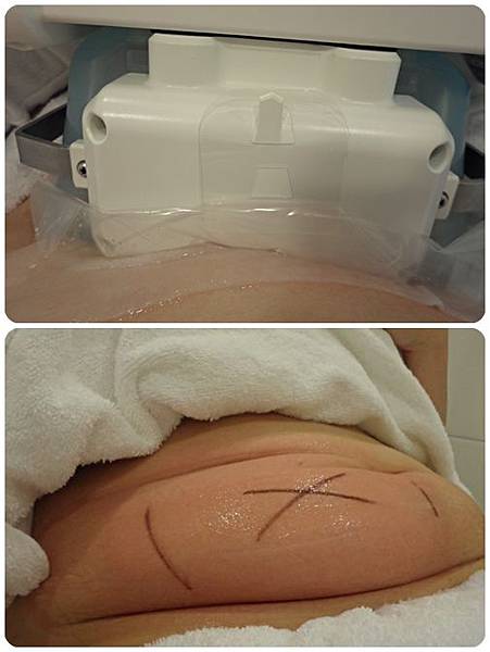 照片 12111 照片 12111