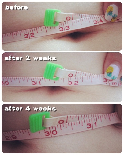 照片 12625 照片 12625