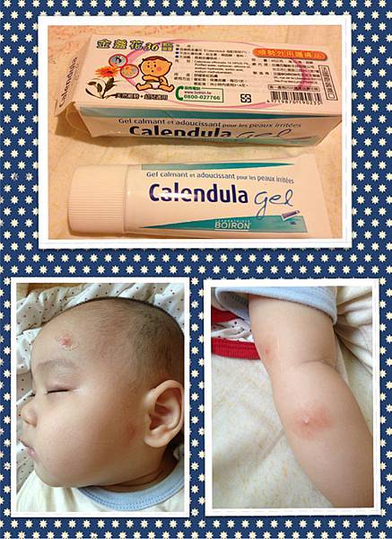 法國BOIRON金盞花敏紅凝露