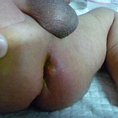 圖片辨識專區-天氣晴--我家肛門口那顆是婁管，想了解這是什麼?