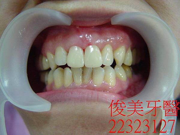 穗120724( 3) 穗120724( 3)