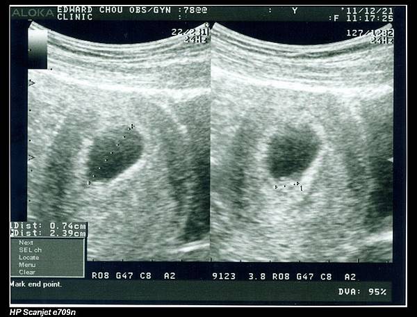 余小龍-7wk1-1.jpg 余小龍-7wk1-1.jpg