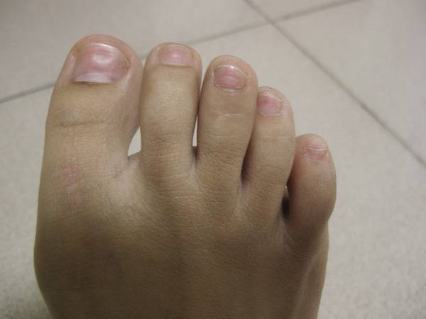 IMG_2603_meitu_6 試用