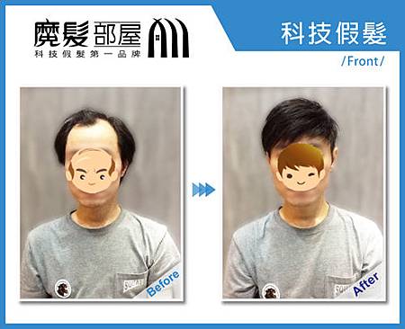 科技假髮1 科技假髮1