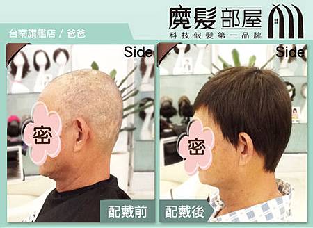 醫療假髮2 醫療假髮2