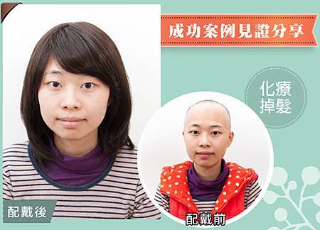 醫療假髮病友推薦 醫療假髮病友推薦