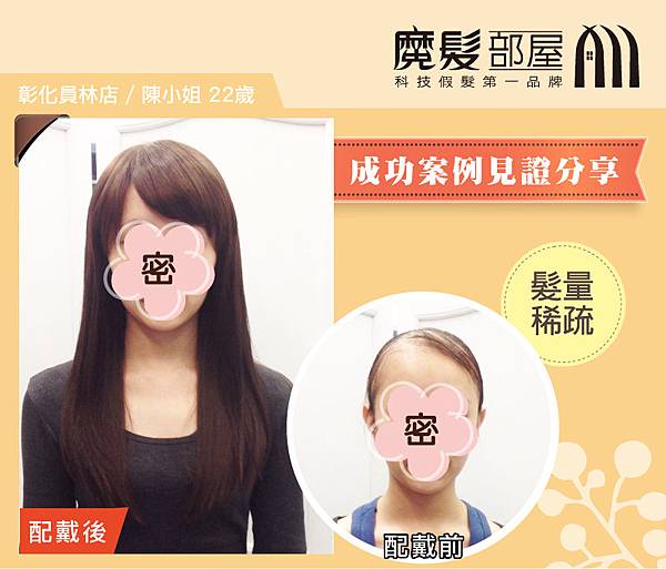 髮量稀疏_員林店陳小姐22歲_1 髮量稀疏_員林店陳小姐22歲_1