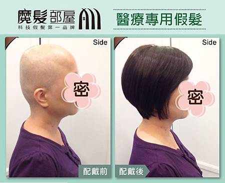 化療掉髮醫療假髮2 化療掉髮醫療假髮2