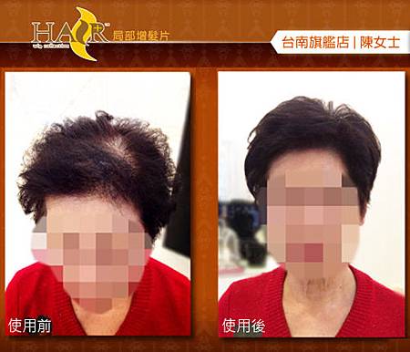 微增髮片 微增髮片