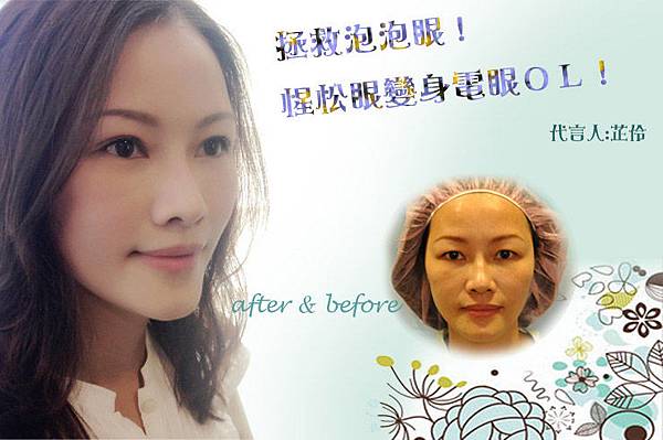 BANNER網頁用.jpg 台中雙眼皮、台中雙眼皮手術推薦、混血精靈系、台中混血瞳、台中眼部整形、台中縫雙眼皮、台中割雙眼皮、台中韓式雙眼皮、台中日式訂書針雙眼皮、台中八字縫雙眼皮、台中開眼頭、開眼尾、台中提眼瞼肌手術、台中大小眼調整、台中雙眼皮手術價格、台中縫雙眼皮費用、台中雙眼皮手術醫生醫師推薦、台中雙眼皮權威名醫、台中整形外科醫學美容、台中菲仕美診所、台灣眼部整形專家,林孟羲院長|楊學穎醫師|許永昌醫師|朱純慧醫師
