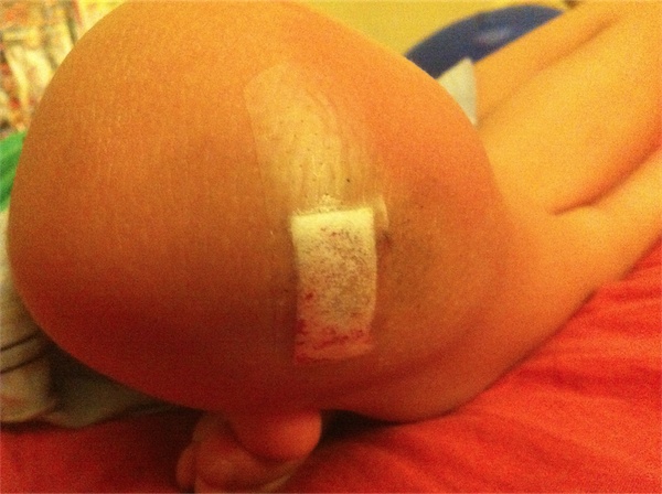 Todd騎腳踏車跌倒膝蓋流血