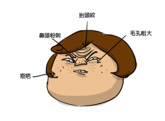 鼻妹急速飛針05 鼻妹急速飛針05