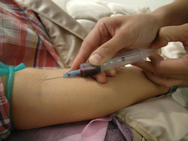 鼻妹急速飛針12 鼻妹急速飛針12