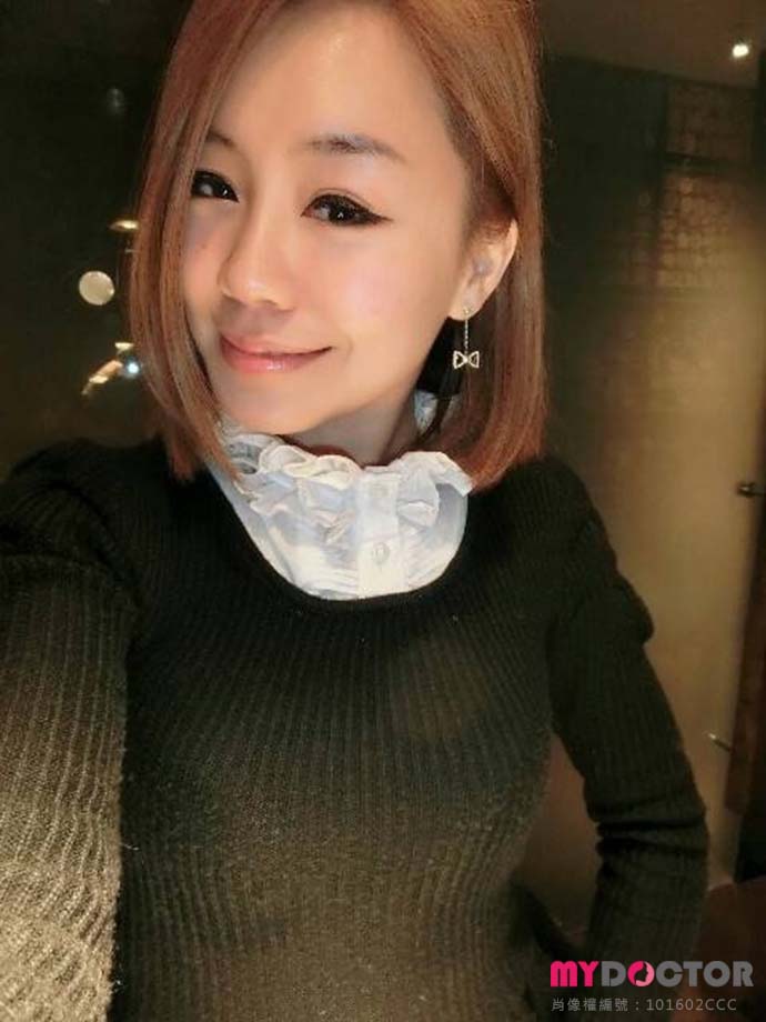 法令紋-生活照04 法令紋-生活照04