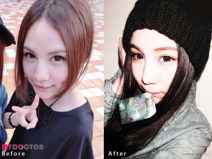 B+A-1_轉正 B+A-1_轉正