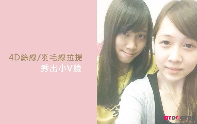 術後露臉01 術後露臉01