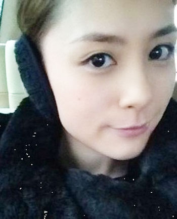 維格縫雙眼皮2 維格縫雙眼皮2