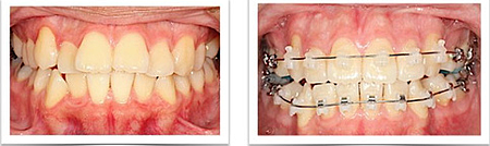 螢幕快照 2013-09-12 下午3.22.59 螢幕快照 2013-09-12 下午3.22.59