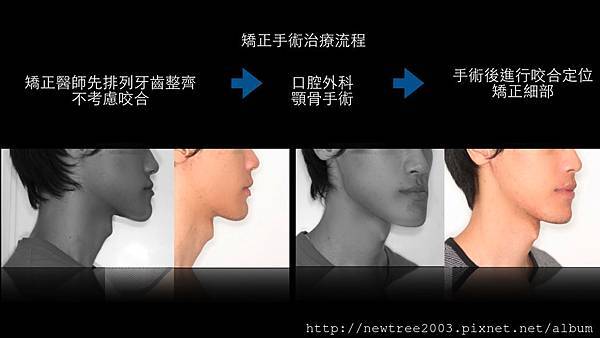 OGS Class III 1.001_Beautune_20140804