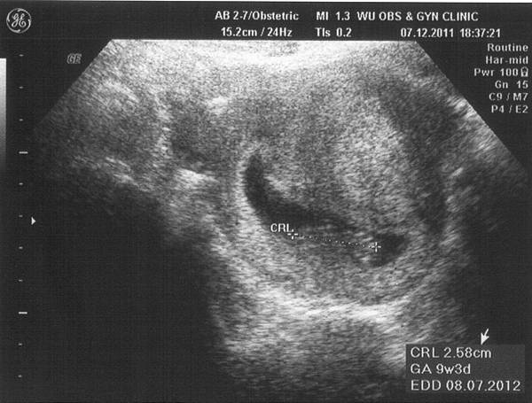 9W-小碗豆 GET.jpg 9W-小碗豆 GET.jpg