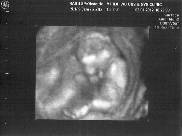 13W-害羞的小寶貝 13W-害羞的小寶貝