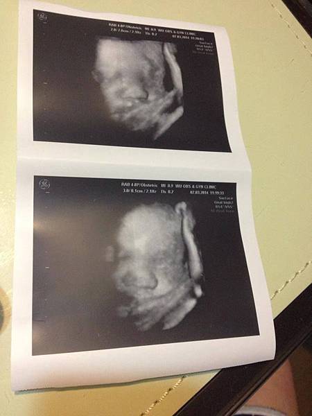 999146_10203093523608797_1679599461_n