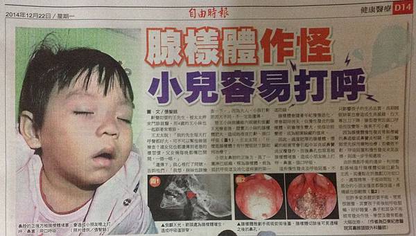 141222腺樣體作怪 小兒容易打呼 141222腺樣體作怪 小兒容易打呼