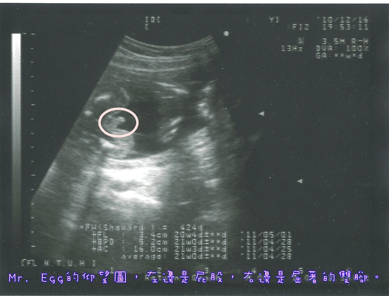 Mr. Egg 20th week (blog).jpeg