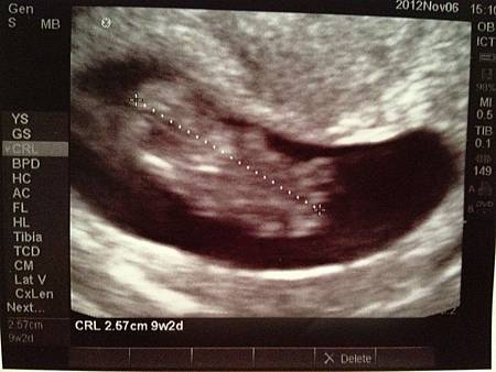 Photo Nov 08, 3 38 19 PM