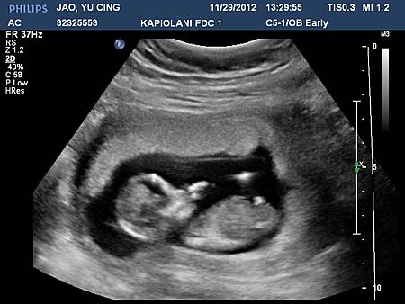 JAOYU CING20121129132956513