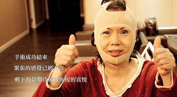 16全臉逆齡拉皮手術.jpg 16全臉逆齡拉皮手術.jpg