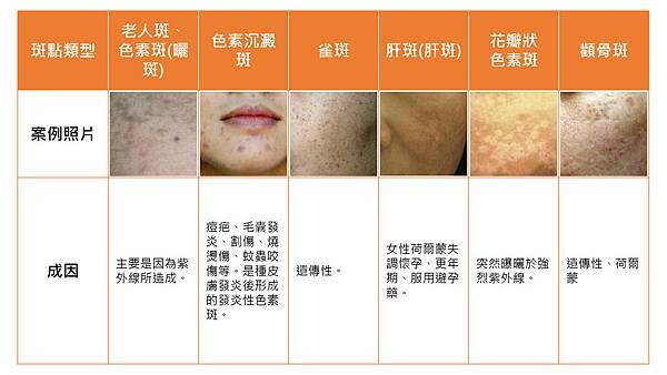 「除斑」的圖片搜尋結果