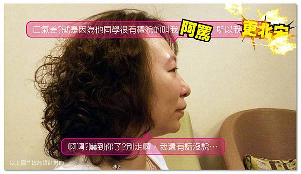 台中電波拉皮菲仕美04 台中電波拉皮菲仕美04