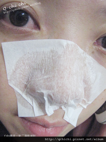 t'do踢荳一貼二淨粉刺貼-步驟2拔 t'do踢荳一貼二淨粉刺貼-步驟2拔