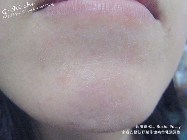 理膚寶水-多容安極效舒緩修護精華乳潤澤型-試用前 理膚寶水-多容安極效舒緩修護精華乳潤澤型-試用前