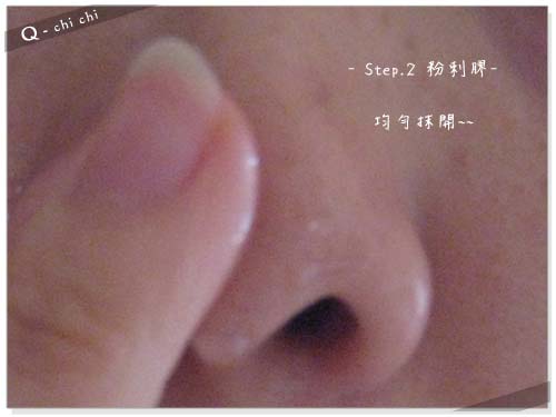 塗粉刺膠.jpg 塗粉刺膠.jpg