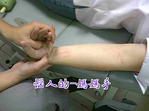 痛死人不償命的媽媽手 痛死人不償命的媽媽手
