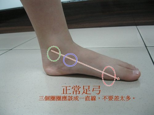 داستان+سکس+از+عقب 居家自我檢測小朋友是否扁平足?或高弓足? @ 扁平足 ...
