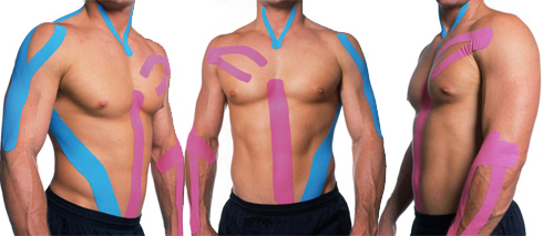 kinesio-taping